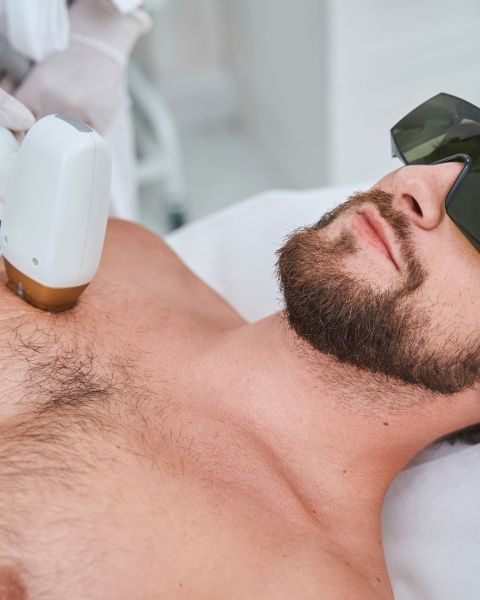 Epilation lumière pulsée