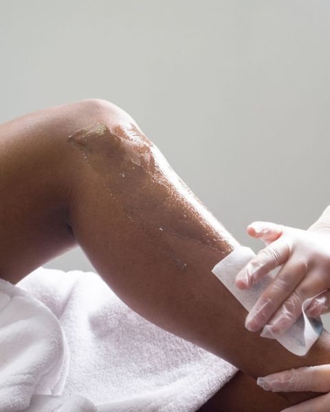 Epilation lumière pulsée
